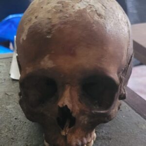 “Real human skull with visible bone texture and natural coloration, photographed as an anatomical display piece.”