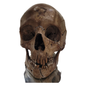 Real Human Skull – Authentic Anatomical Specimen